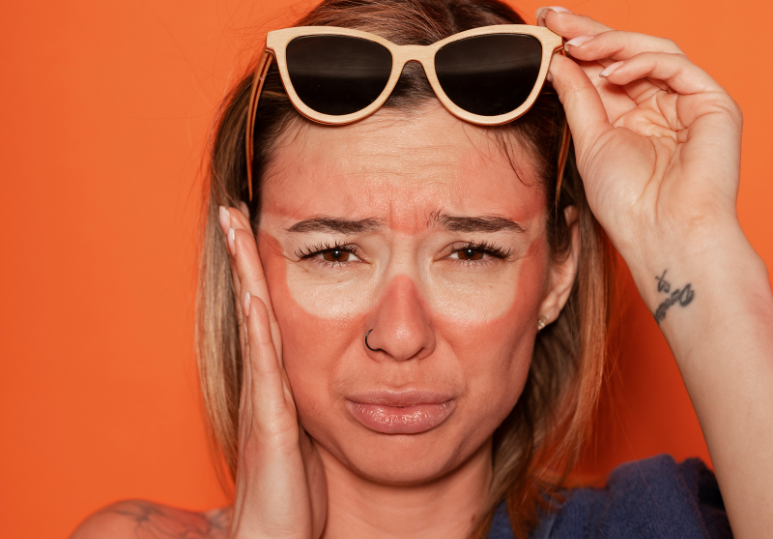 Is It Too Late to Fix Sun Damaged Skin? Professional Treatments That Restore Your Skin After Summer